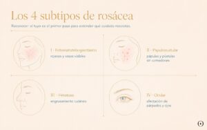 Infografía con los cuatro subtipos clásicos de rosácea: eritematotelangiectásico, papulopustular, fimatoso y ocular.